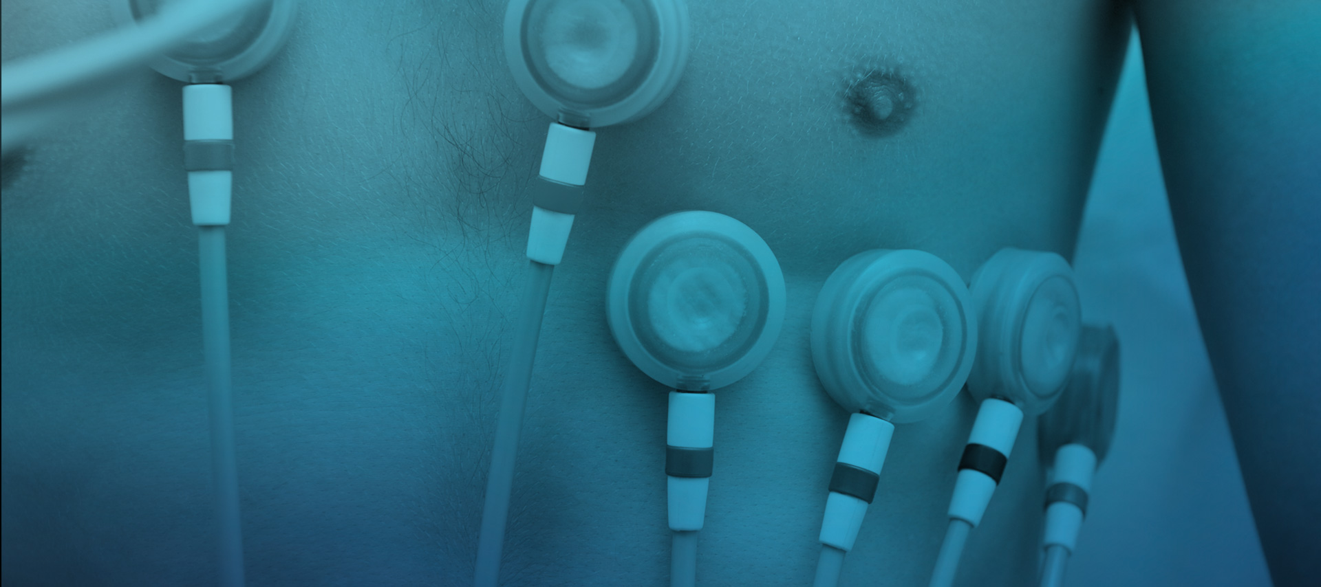 Conectividad directamente desde la piel